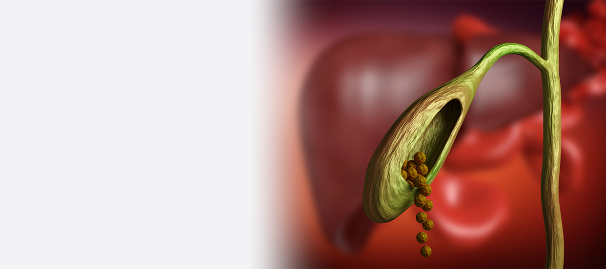 Bile Duct Cancer: Symptoms, Risk Factors, Diagnosis, and Treatment Choices